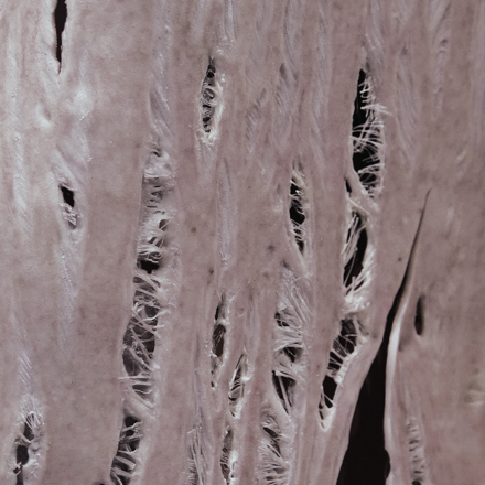 artwork-440x440.jpg